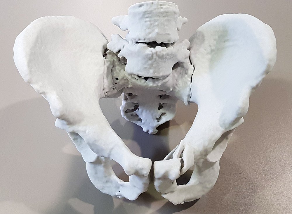 Most of the anatomical models relate to fractures (e.g. pelvis or heel fractures and spine trauma) and bone cancer.