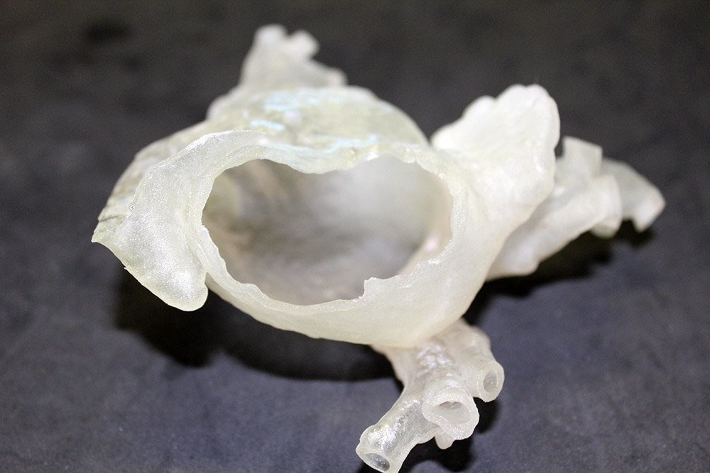 3D printing provides a concrete and precise reproduction of the morphological and pathological aspects of the heart chambers.