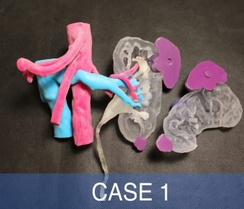 case12-min