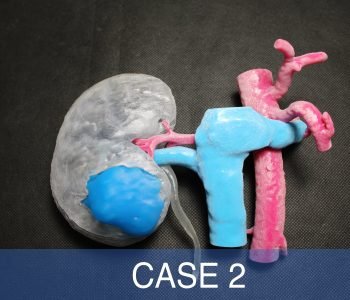 case21-min
